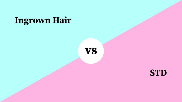 Differences Between Ingrown Hair and STD