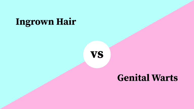 Differences Between Ingrown Hair and Genital Warts