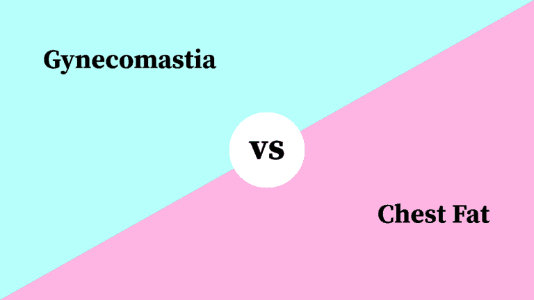 Differences Between Gynecomastia and Chest Fat